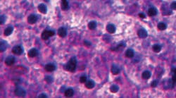 Organovo&apos;s 3-D bioprinted liver tissue, pictured above, closely reproduces cellular patterns found in native tissue. (Photo courtesy of Organovo)