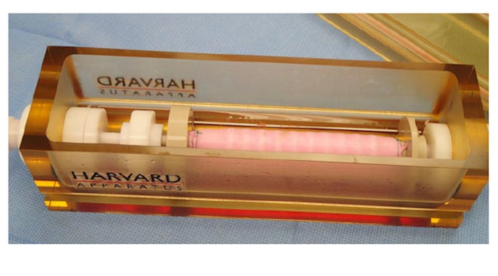 The bioreactor, a specialized rotating incubator, seeds the patient&apos;s bone marrow cells onto a synthetic trachea scaffold (pink).