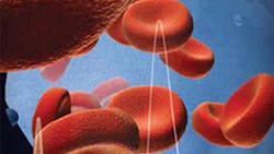 Medtech Firm Fined by US for Bribes in Russia Vietnam Thailand Medtech Firm Fined by US for Bribes in Russia Vietnam Thailand