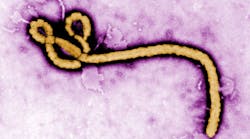 A colorized transmission electron micrograph of an Ebola virus virion. (Photo by Centers for Disease Control via Getty Images)