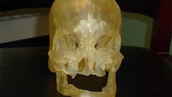 3D Printing and Facial Transplants 3D Printing and Facial Transplants