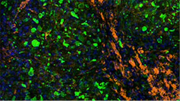 Bioprinting Tissue for Human Transplantation Moving Closer with New Collaboratio