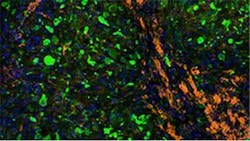Bioprinting Tissue for Human Transplantation Moving Closer with New Collaboratio Bioprinting Tissue for Human Transplantation Moving Closer with New Collaboratio