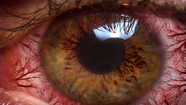 Most Americans Experience Digital Eye Strain from Overexposure to