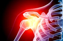 Industryweek Com Sites Industryweek com Files Shoulder Xray Raycat Istock Getty Industryweek Com Sites Industryweek com Files Shoulder Xray Raycat Istock Getty