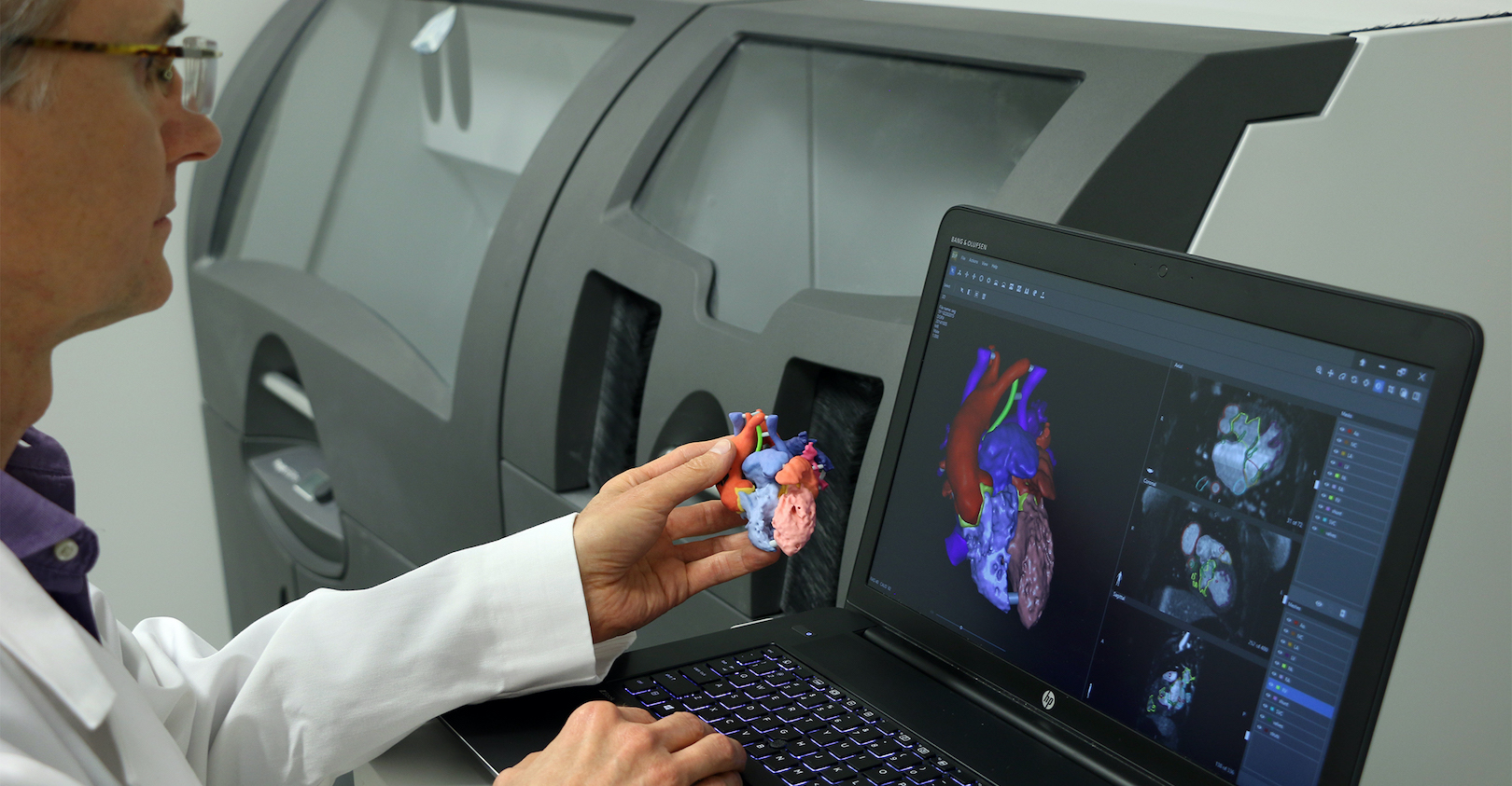 Point-of-care (POC) facilities increasingly show interest in using 3D solutions as new technology emerges, becomes more user friendly, and incorporates automation.