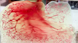 Human vasculature model created using Print to Perfusion process.