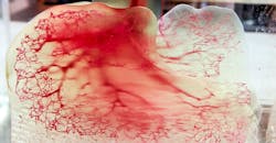 Human vasculature model created using Print to Perfusion process. Human vasculature model created using Print to Perfusion process.
